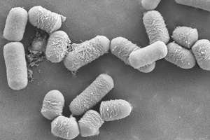 Probiotic trio enhances cardiometabolic health, studies find