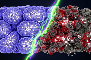 Pycnogenol: a powerful extracellular matrix activator for skin, joint, eye care and more (part I)