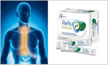 RefluG: strategies for the symptomatic relief of GORD