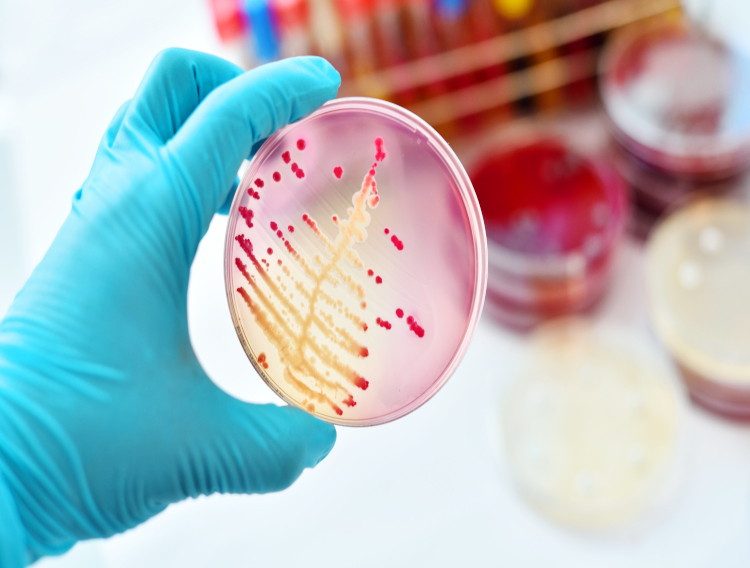 Research indicates probiotics may provide anti-cancer benefits