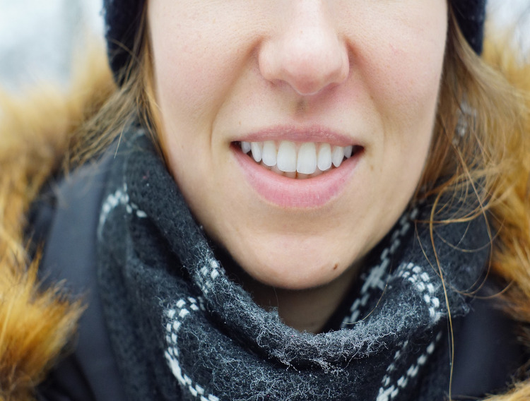 Research reinforces Sabinsa curcumin ingredient's oral health benefits