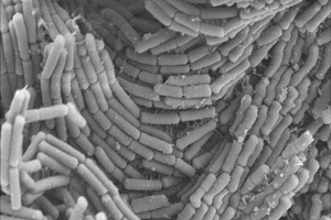Research reveals the "natto-kin" strain that can boost immunity