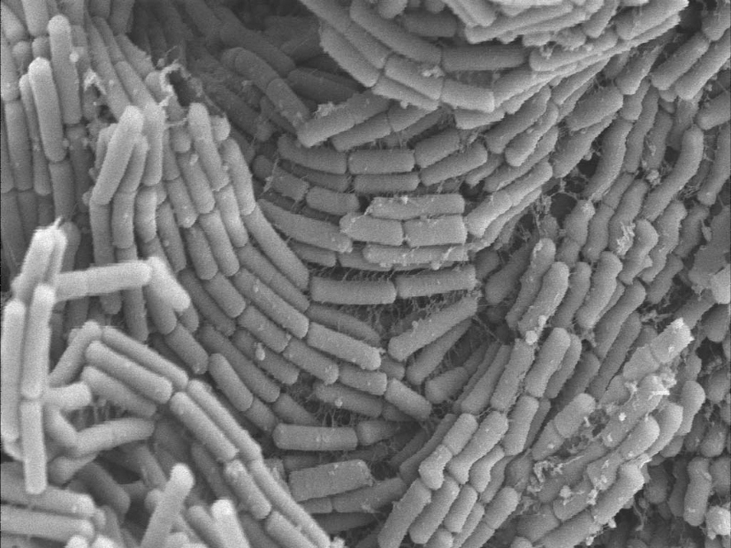 Research reveals the "natto-kin" strain that can boost immunity