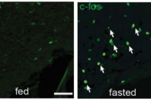 Scientists discover the tuberal nucleus' role in controlling appetite and body weight