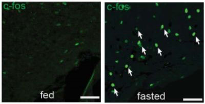 Scientists discover the tuberal nucleus' role in controlling appetite and body weight
