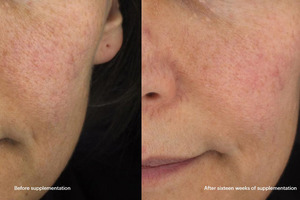 Seeing is believing: new study provides visible evidence  of benefits of Lycoderm for skin