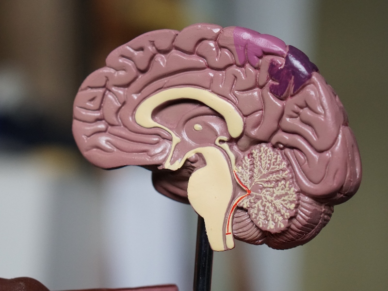 Study reveals supplement's effect on slowing down Alzheimer’s dementia