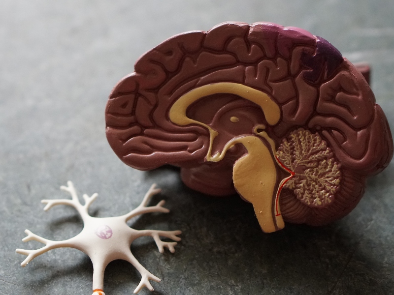Study reveals supplement to repress genes associated with Alzheimer’s Disease
