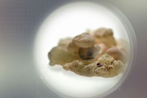 Thanks to Casperome – Indena’s Boswellia Phytosome – maintaining a healthy gut is natural and safe