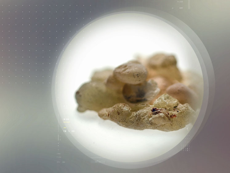 Thanks to Casperome – Indena’s Boswellia Phytosome – maintaining a healthy gut is natural and safe