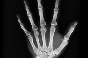 Vitae Naturals launches a new product: AK Bone
