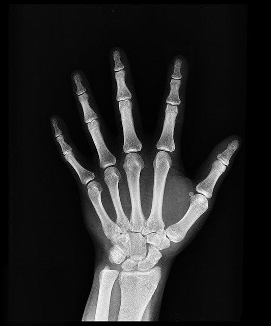 Vitae Naturals launches a new product: AK Bone
