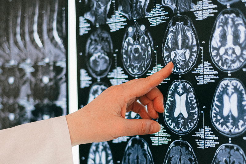 Vitamin K2 can tackle neuroinflammation and degeneration, study finds