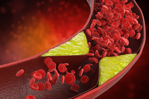 Vitamin K2 for cardiovascular and bone health 