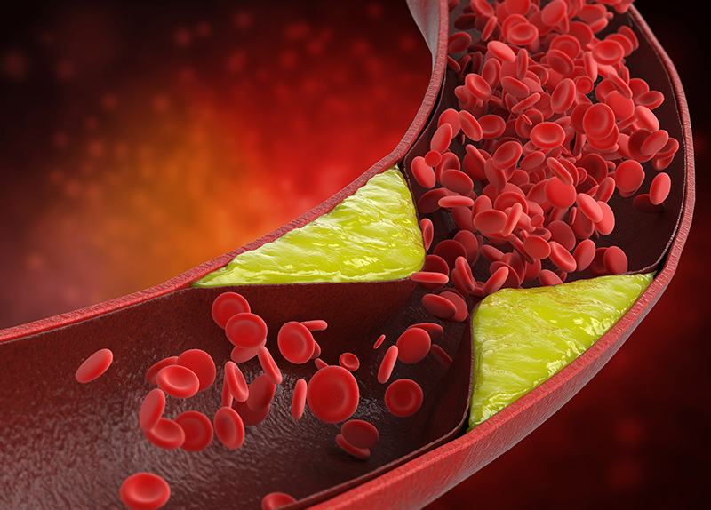 Vitamin K2 for cardiovascular and bone health 