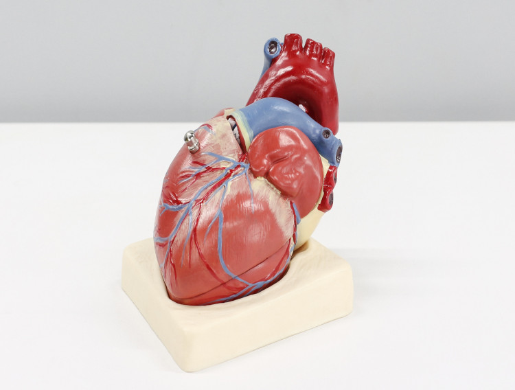 Vitamin K2 may prevent vascular calcification
