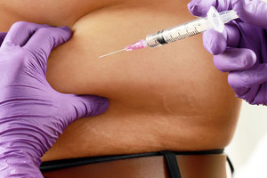 What next for the injectable revolution?