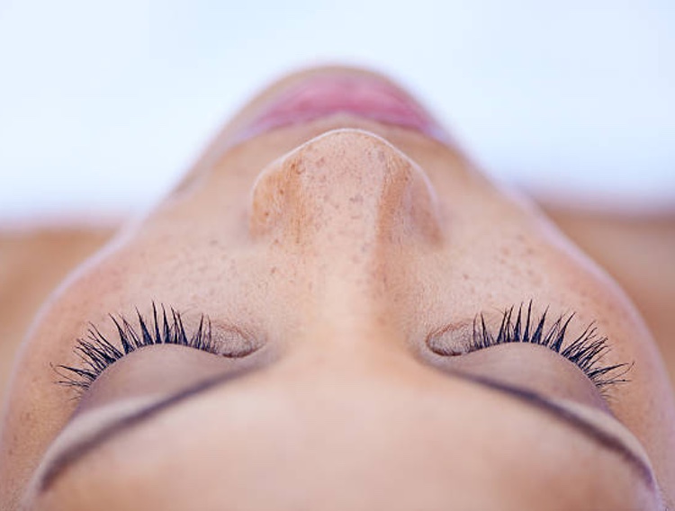 Winclove Probiotics collaborates on probiotic functional food for psoriasis